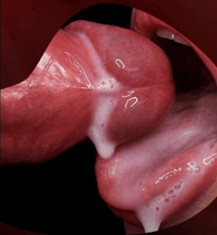 Técnicas de Prazer Oral